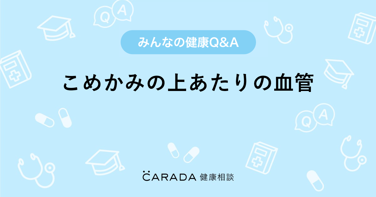 こめかみの上あたりの血管 Carada 健康相談 医師や専門家に相談できる医療 ヘルスケアのq Aサイト