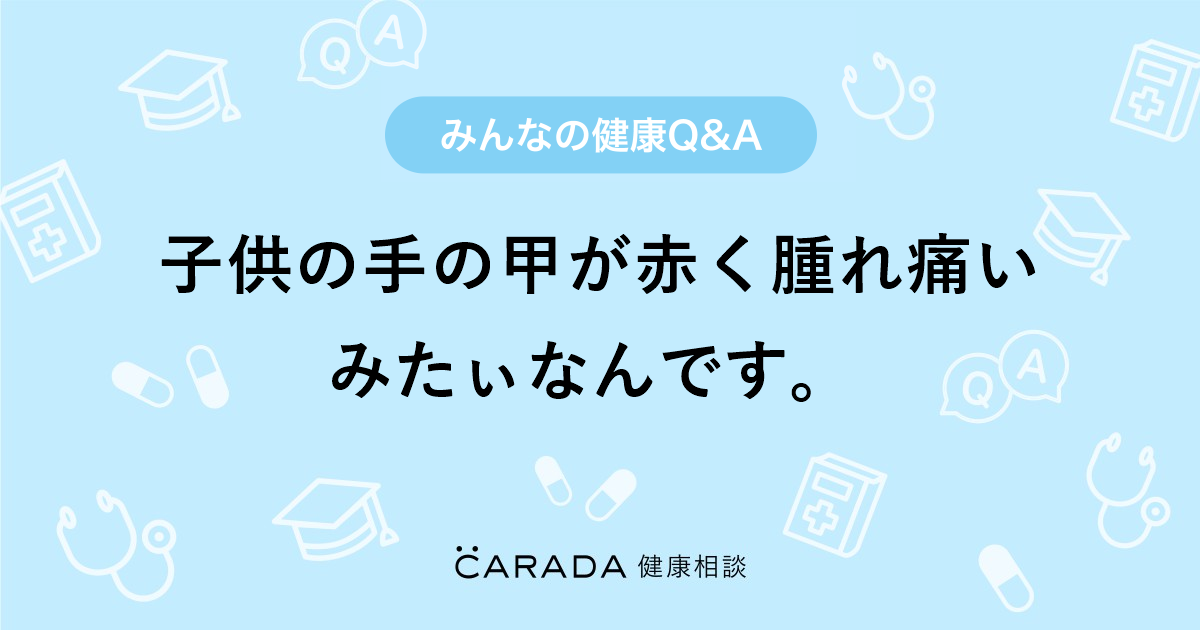 子供の手の甲が赤く腫れ痛いみたぃなんです 皮膚科の相談 チャグじぃさん 28歳 女性 の投稿 Carada 健康相談 医師や専門家に相談できるq Aサイト 30万件以上のお悩みに回答