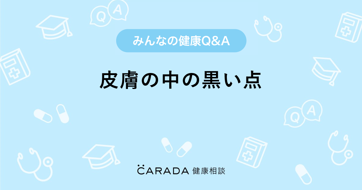 皮膚の中の黒い点 Carada 健康相談 医師や専門家に相談できる医療 ヘルスケアのq Aサイト