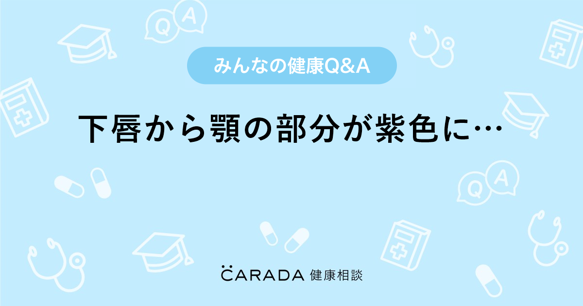 下唇から顎の部分が紫色に Carada 健康相談 医師や専門家に相談できる医療 ヘルスケアのq Aサイト