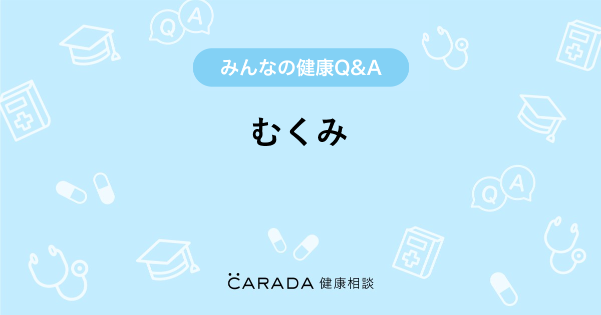 むくみ Carada 健康相談 医師や専門家に相談できる医療 ヘルスケアのq Aサイト