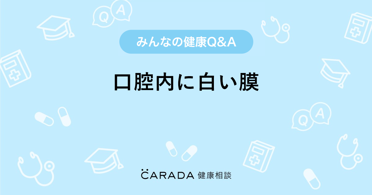 口腔内に白い膜 Carada 健康相談 医師や専門家に相談できる医療 ヘルスケアのq Aサイト