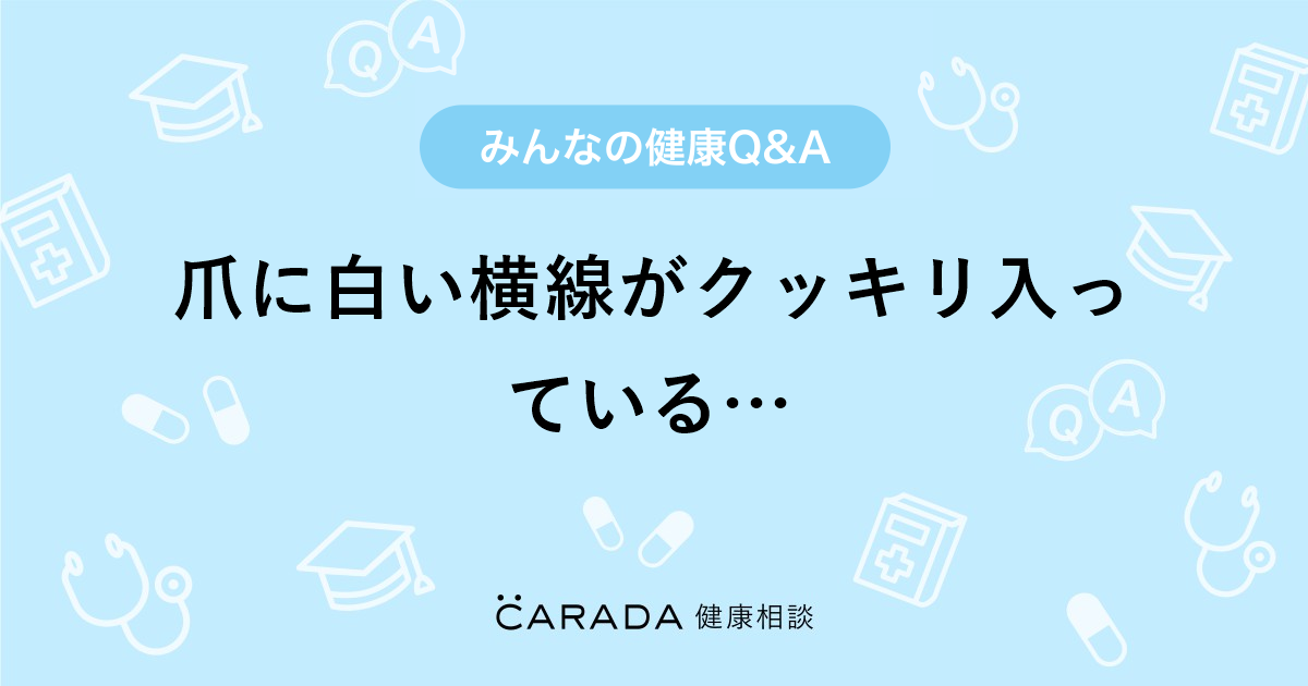 爪に白い横線がクッキリ入っている その他の相談 こうりゅうさん 30歳 女性 の投稿 Carada 健康相談 医師や専門家に相談できるq Aサイト 30万件以上のお悩みに回答 爪に白い横線がクッキリ入っている その他の相談 こうりゅうさん 30歳 女性 の投稿 Carada 健康相談 医師や専門家に相談できるq Aサイト 30万件以上のお悩みに回答