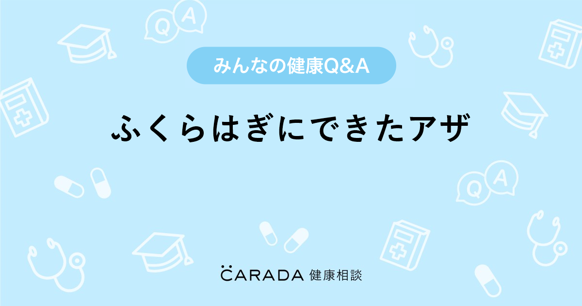 ふくらはぎにできたアザ Carada 健康相談 医師や専門家に相談できる医療 ヘルスケアのq Aサイト