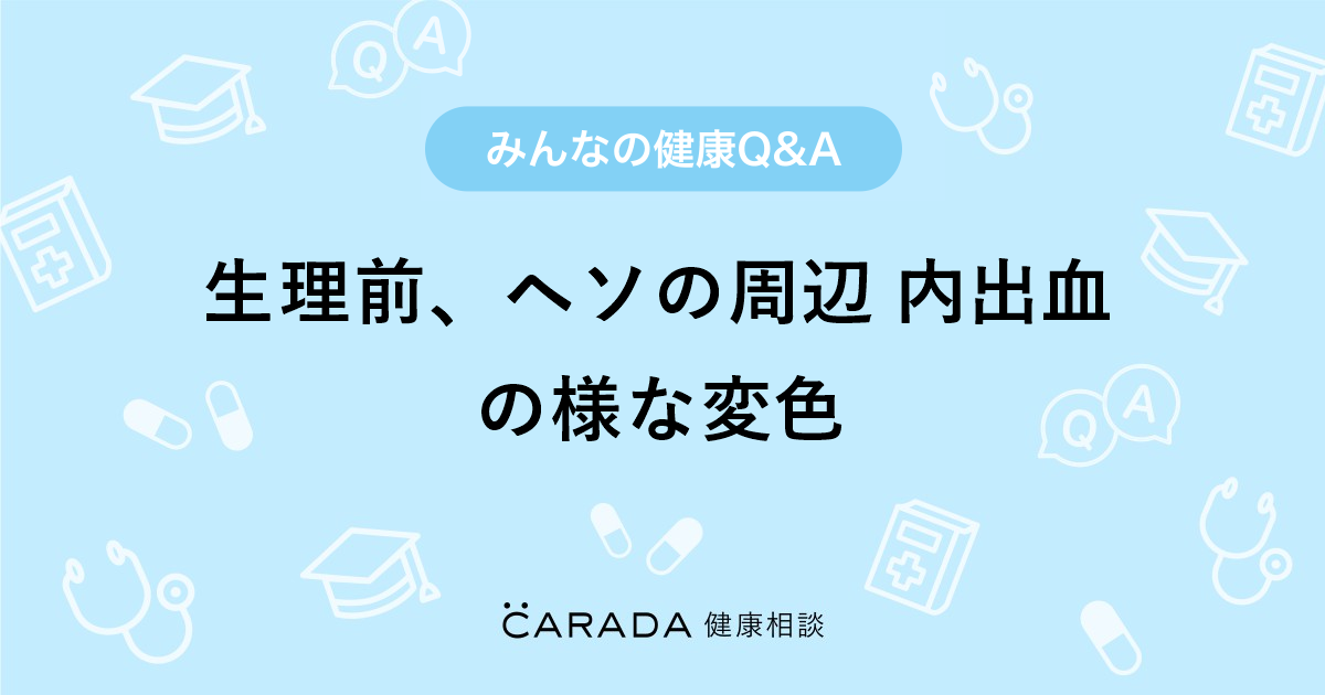 生理前 ヘソの周辺 内出血の様な変色 Carada 健康相談 医師や専門家に相談できる医療 ヘルスケアのq Aサイト