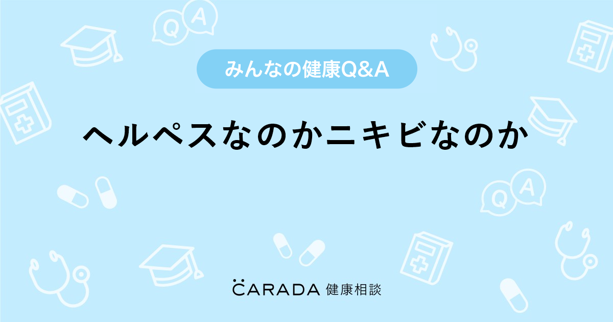 ヘルペスなのかニキビなのか Carada 健康相談 医師や専門家に相談できる医療 ヘルスケアのq Aサイト