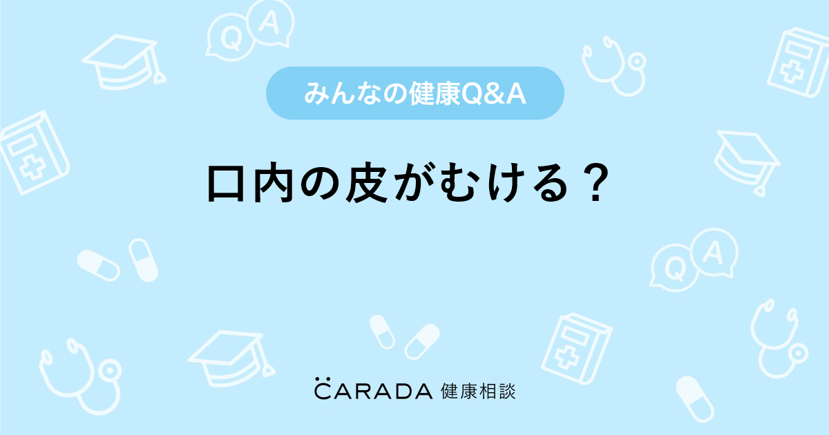 口内の皮がむける Carada 健康相談 医師や専門家に相談できる医療 ヘルスケアのq Aサイト