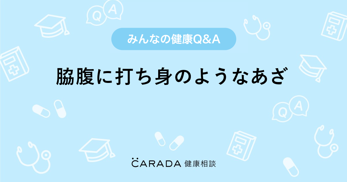 脇腹に打ち身のようなあざ Carada 健康相談 医師や専門家に相談できる医療 ヘルスケアのq Aサイト